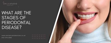 What are the stages of periodontal disease