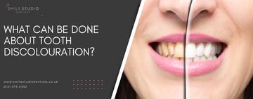 What can be done about tooth discolouration?