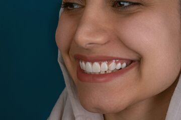 Airflow Polishing for Oral Hygiene