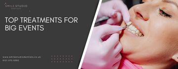 Top treatments for big events
